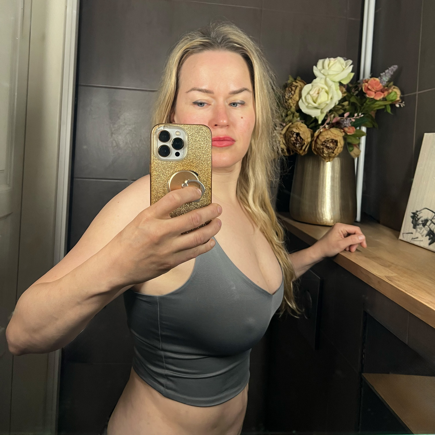 Rasvansiirto rintoihin Rasvansiirto rintoihin