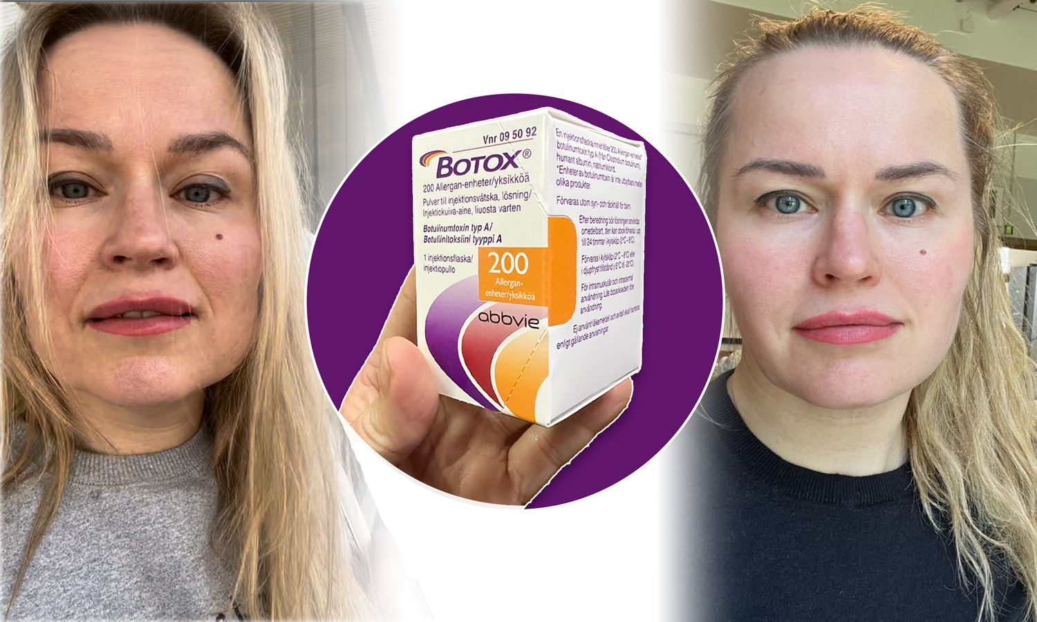 botox-toimittajatestasi botox-toimittajatestasi