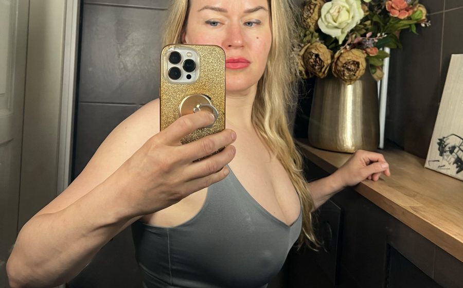 Toimittaja kuukausi rasvansiirron jälkeen, selfie. Toimenpiteessä rasvaa siirrettiin selästä rintoihin.