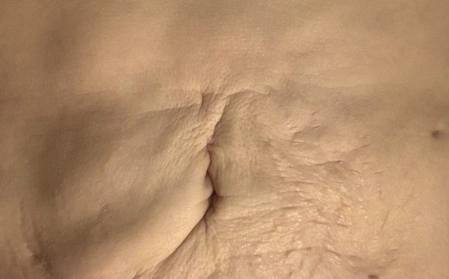 Epätasaisesti ja liian rajulla tekniikalla tehty rasvaimu Virossa. Paikoin rasvaa on jätetty paljon, paikoin otettu liikaa. Liian rajulla tekniikalla on aiheutettu kiinnikkeitä, jotka näkyvät kuroumina